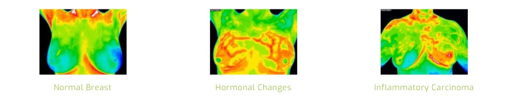 "Ken Je Lichaam en Anticipeer: Thermografische Inzichten in Hormonale Veranderingen"
